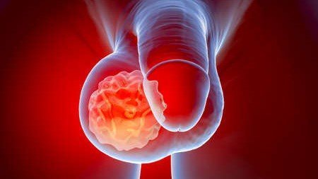 Reprostat är ett modernt kosttillskott utvecklat för män som vill ta hand om sin prostatahälsa på ett naturligt och skonsamt sätt.